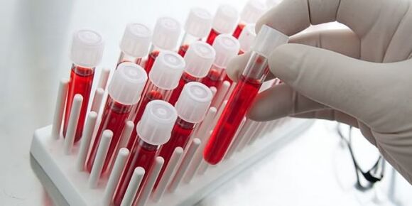 proba de sangue